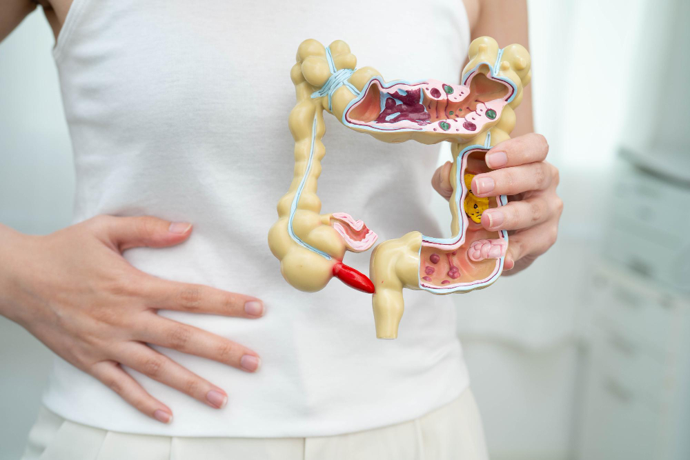 Fermentazione intestinale