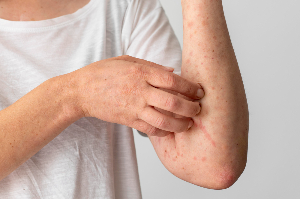 Metabolismo dell’istamina